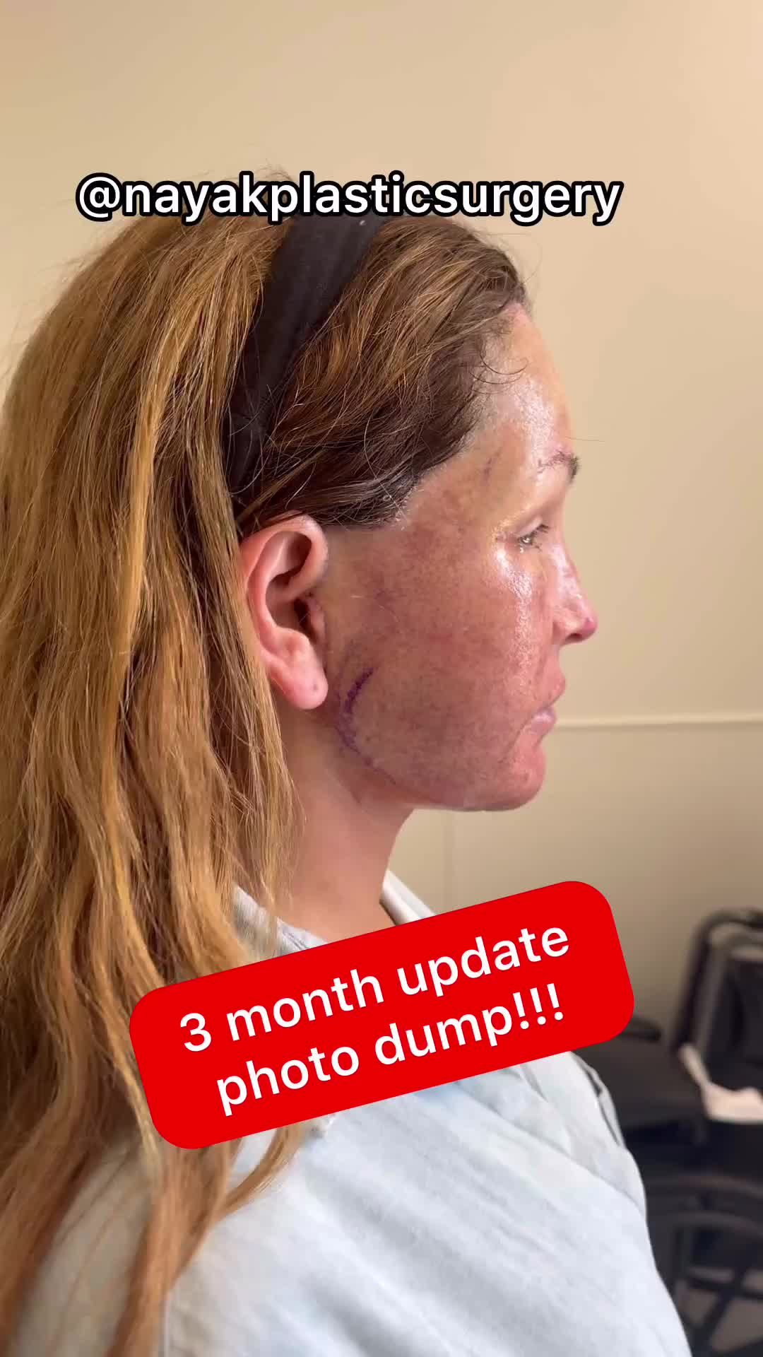 @NayakPlasticSurgery