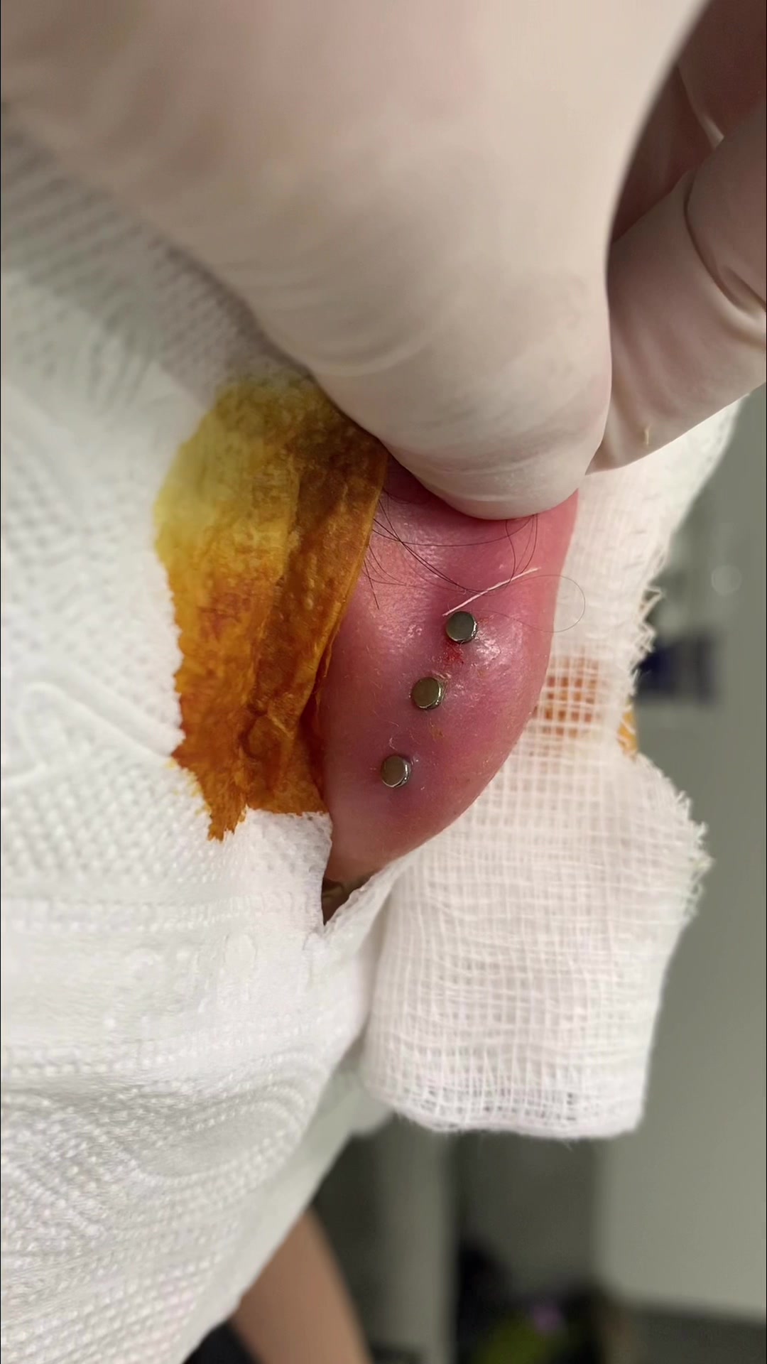 @Piercing - Toothgems