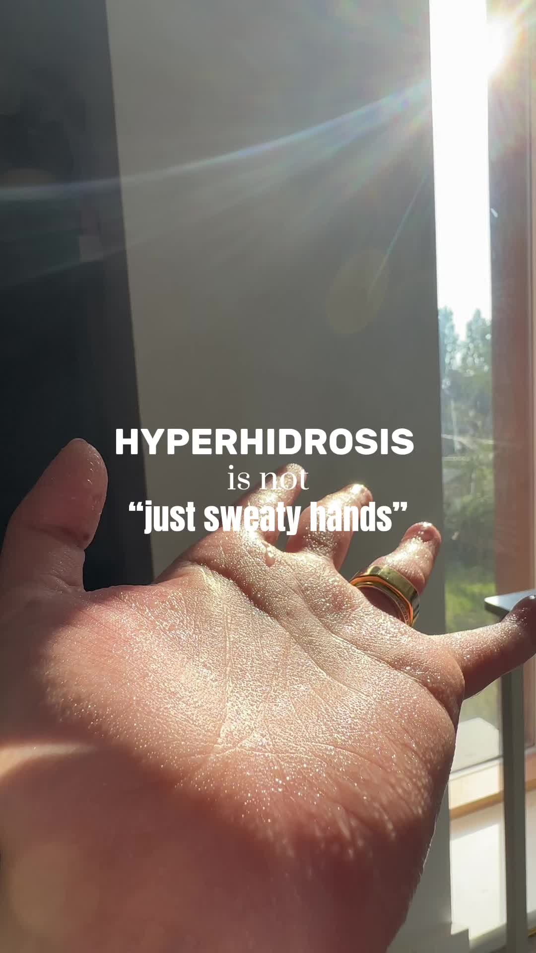 @The Center for Hyperhidrosis