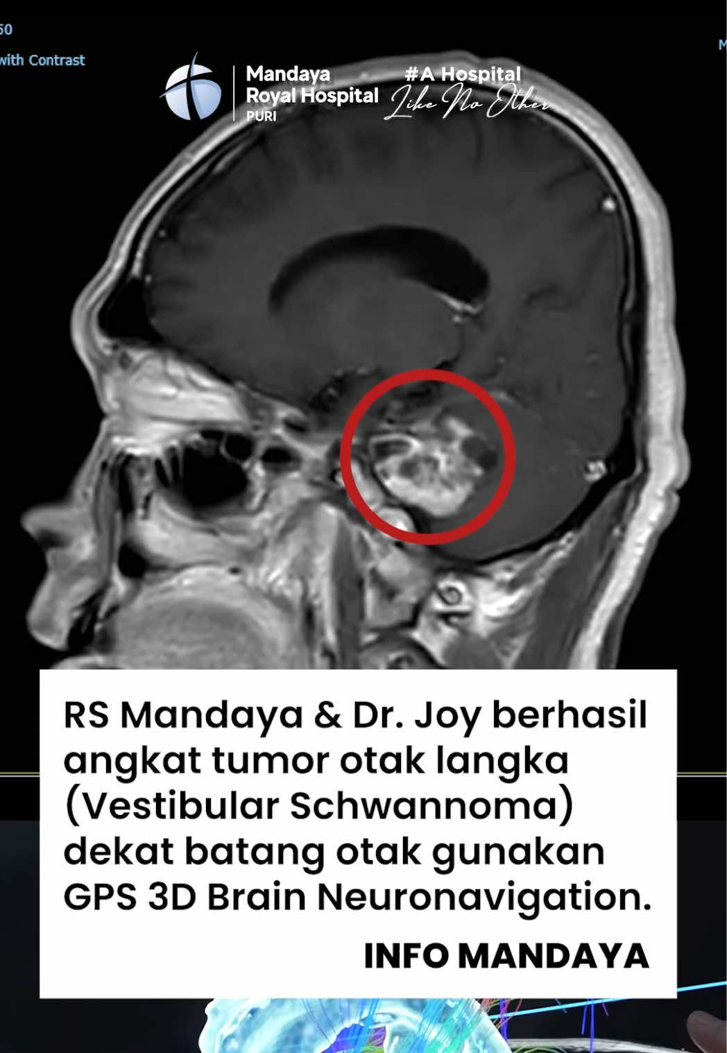 @Mandaya Royal Hospital Puri