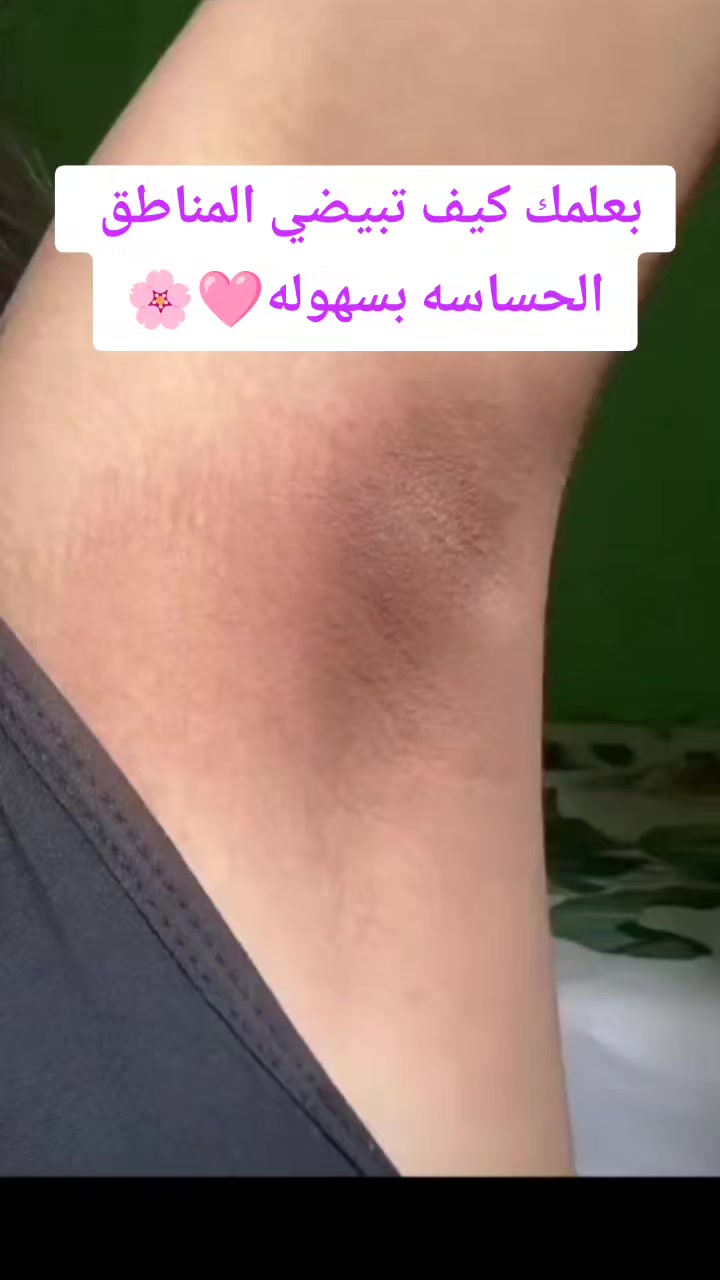 @أسرار الجمال مع ام سعود🎀