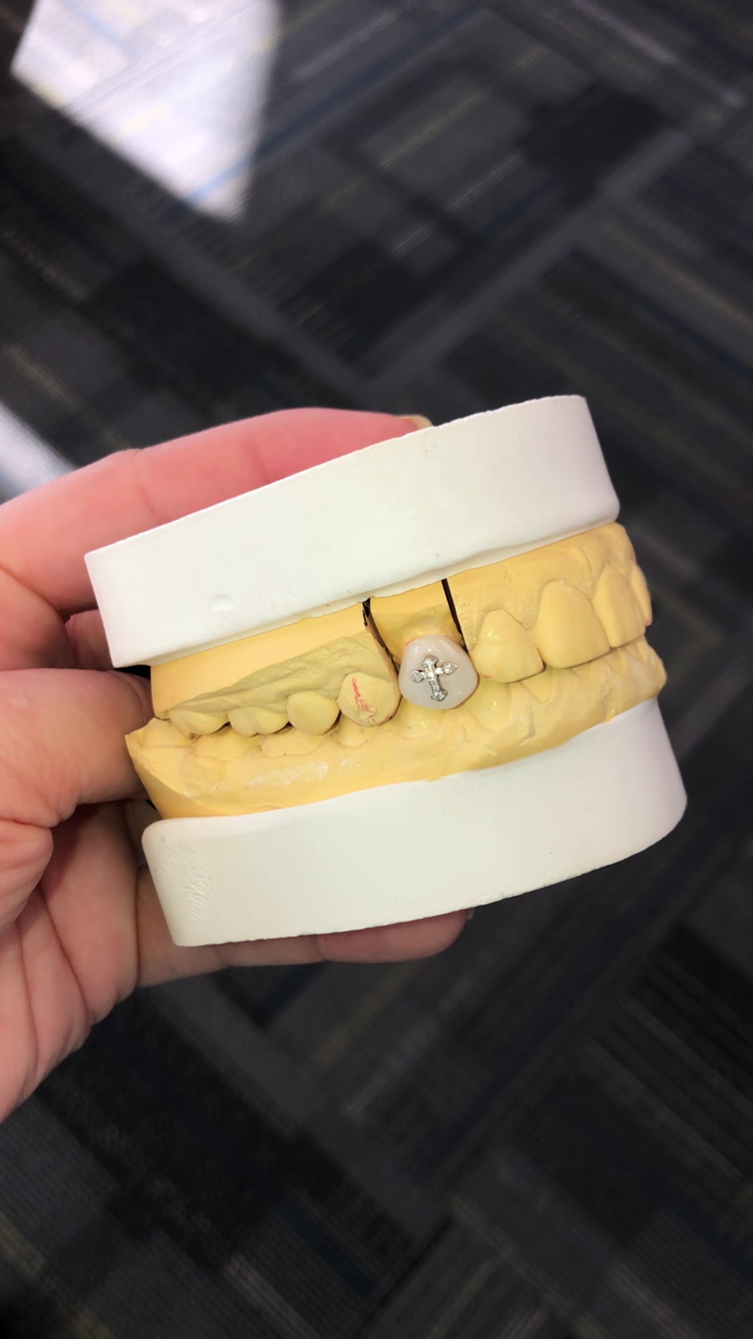 @Utah Valley Dental Lab