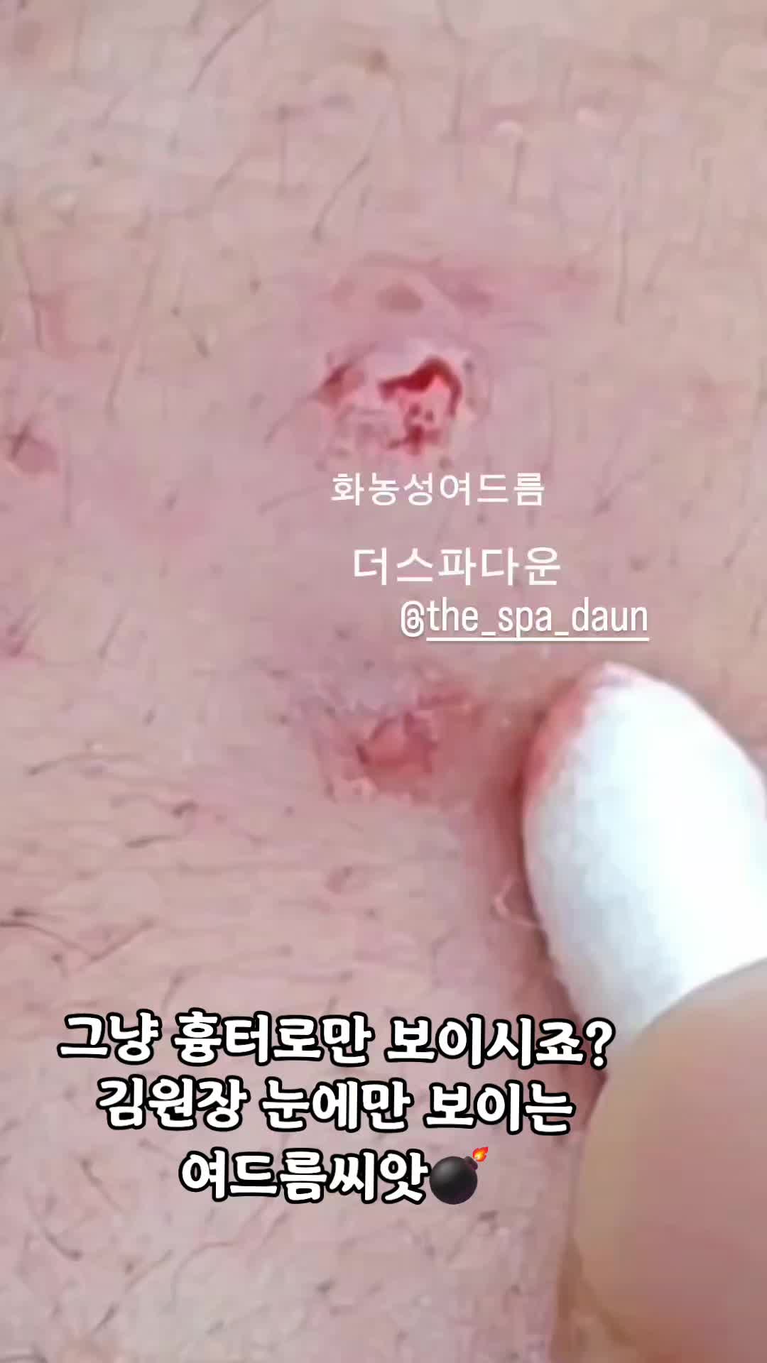 @더스파다운(여드름피부전문스파)