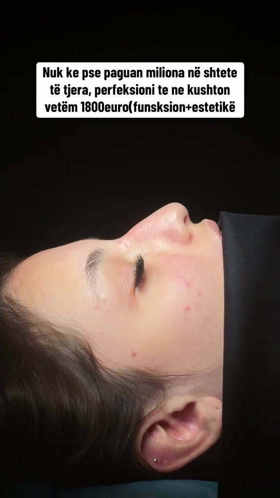 @rinoplasticatirana