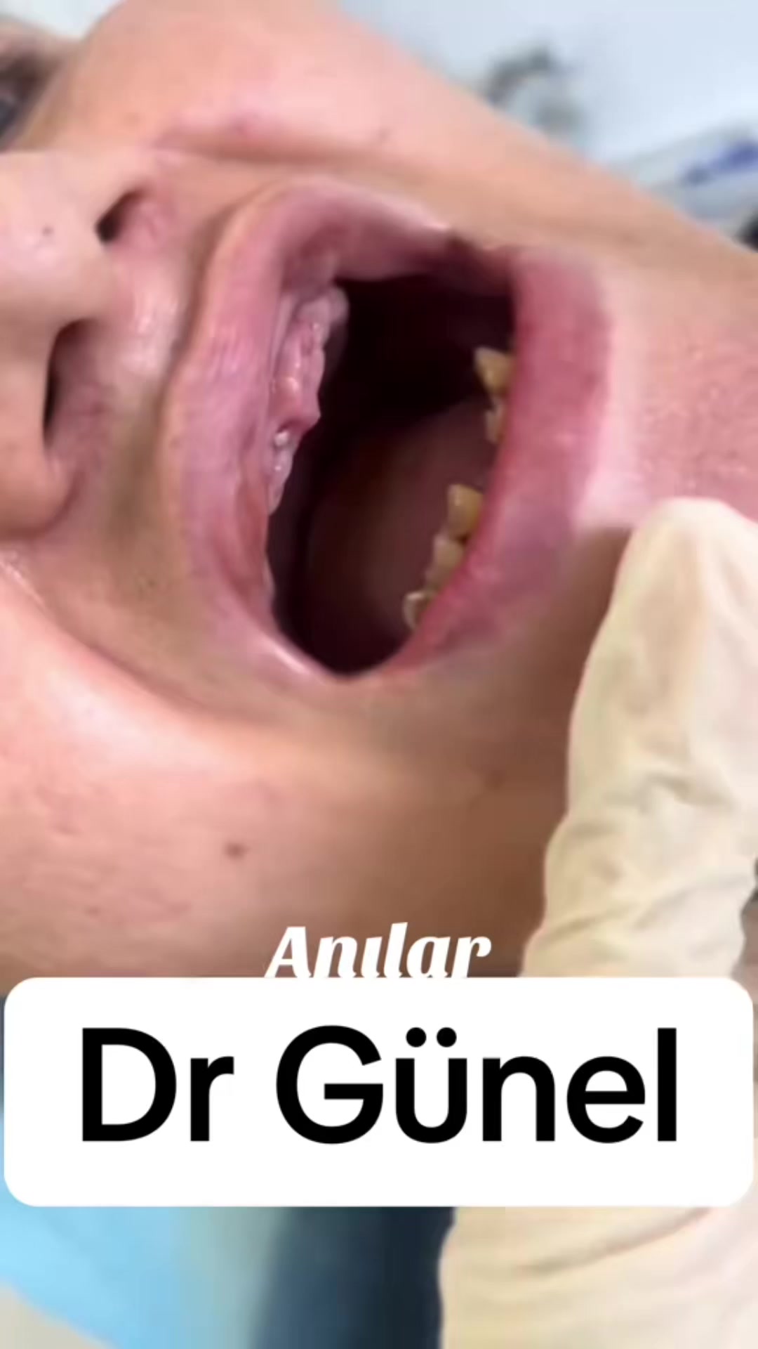 @Dentist_Günel
