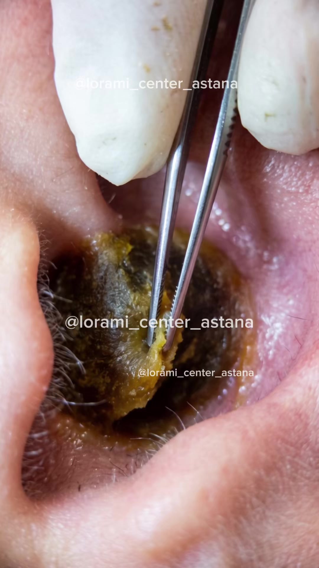 @Lorami_center_astana