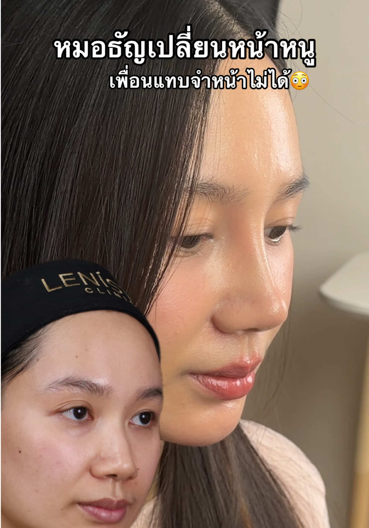 @หมอธัญ LENISTA