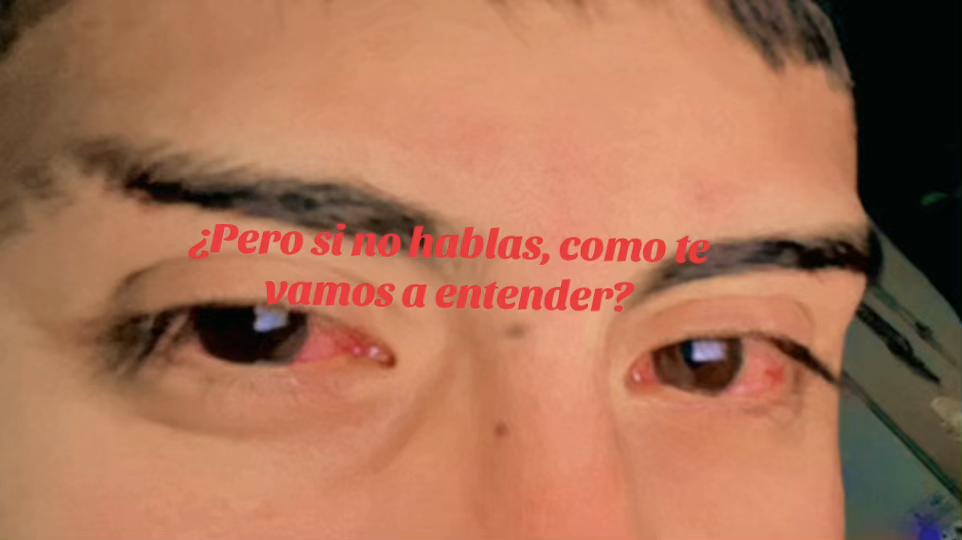 @Alberto 👑