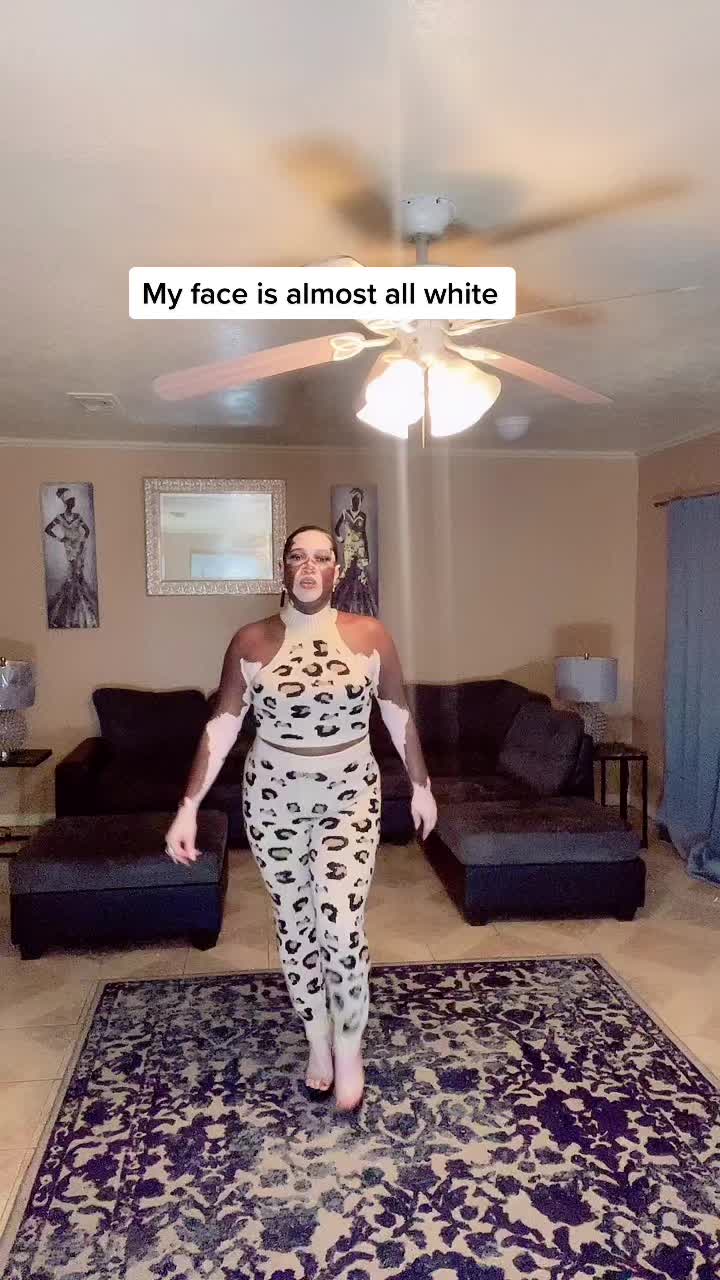 @Iomikoe Johnson