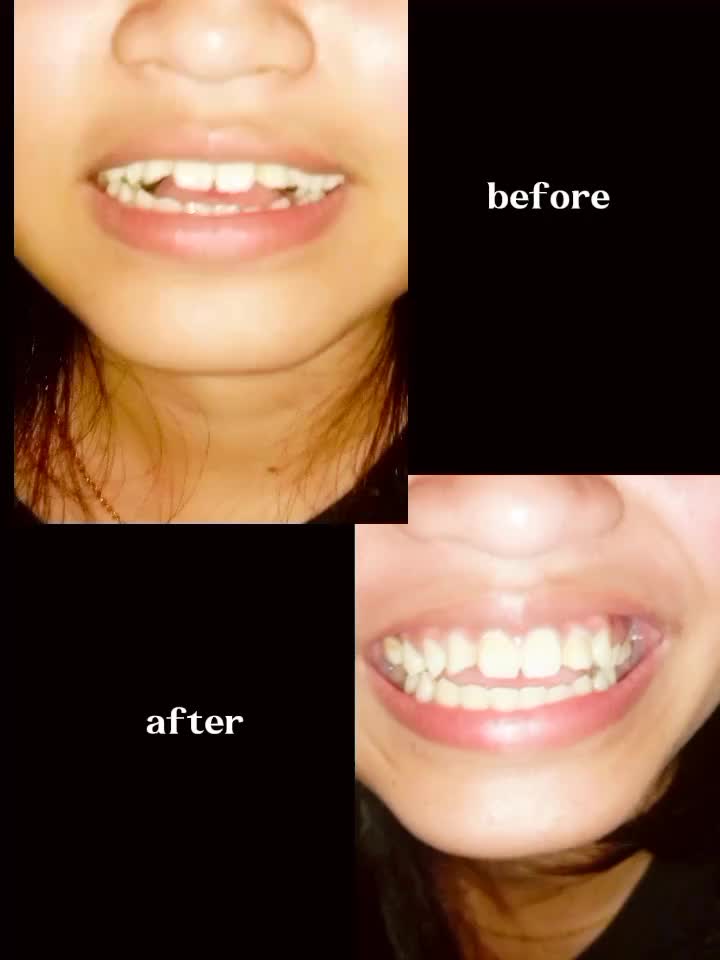 @🥰 iyahcalixellaine 🥰