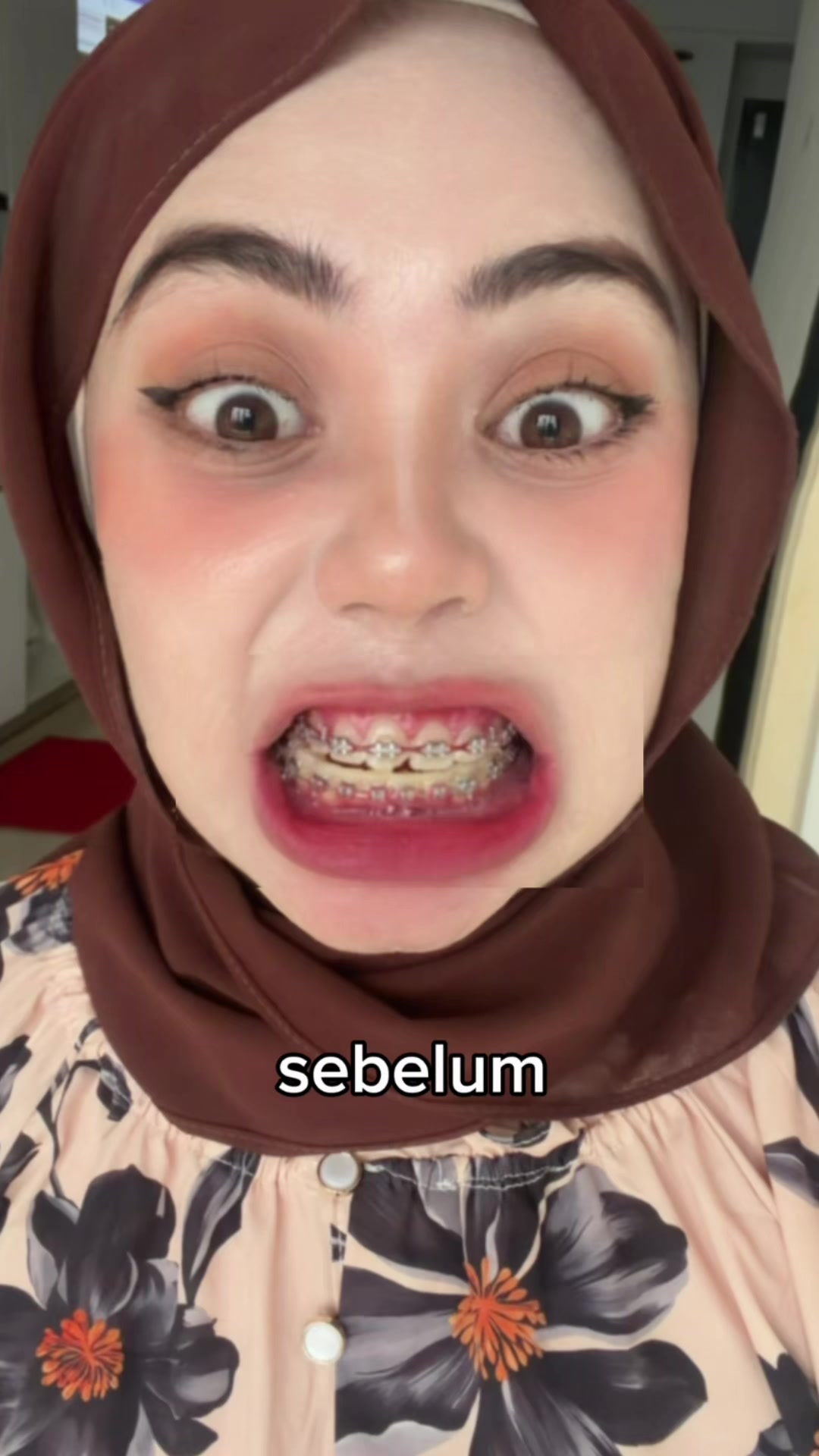 @aini.asyiqinn