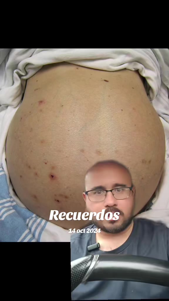@Dr. Ajolote.