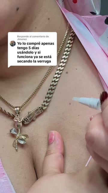 @Rosmery Montero