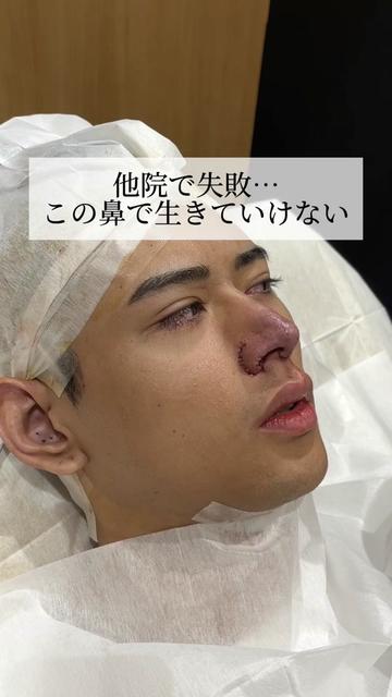 @鼻整形R Beauty CLINIC 副院長👨&zwj;⚕️吉田慧