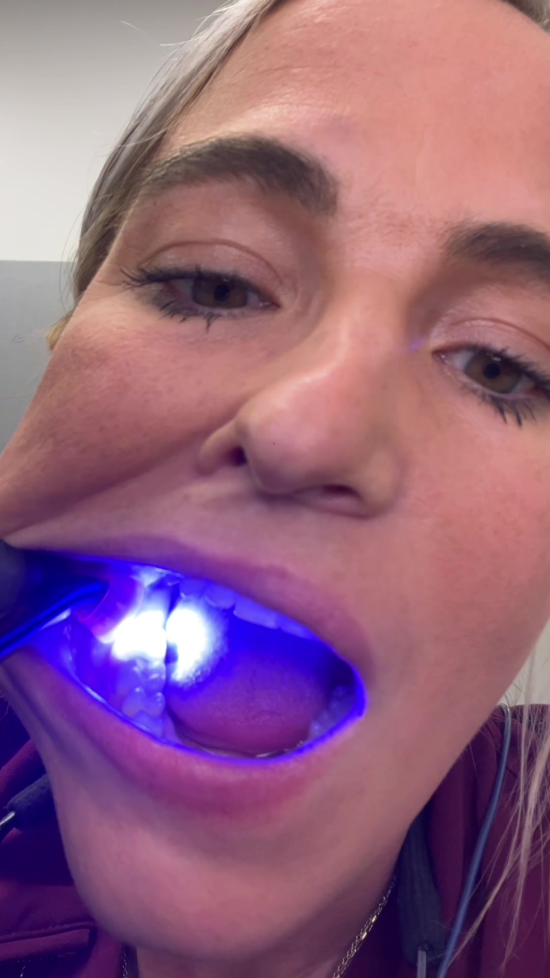 @Dentist_rach