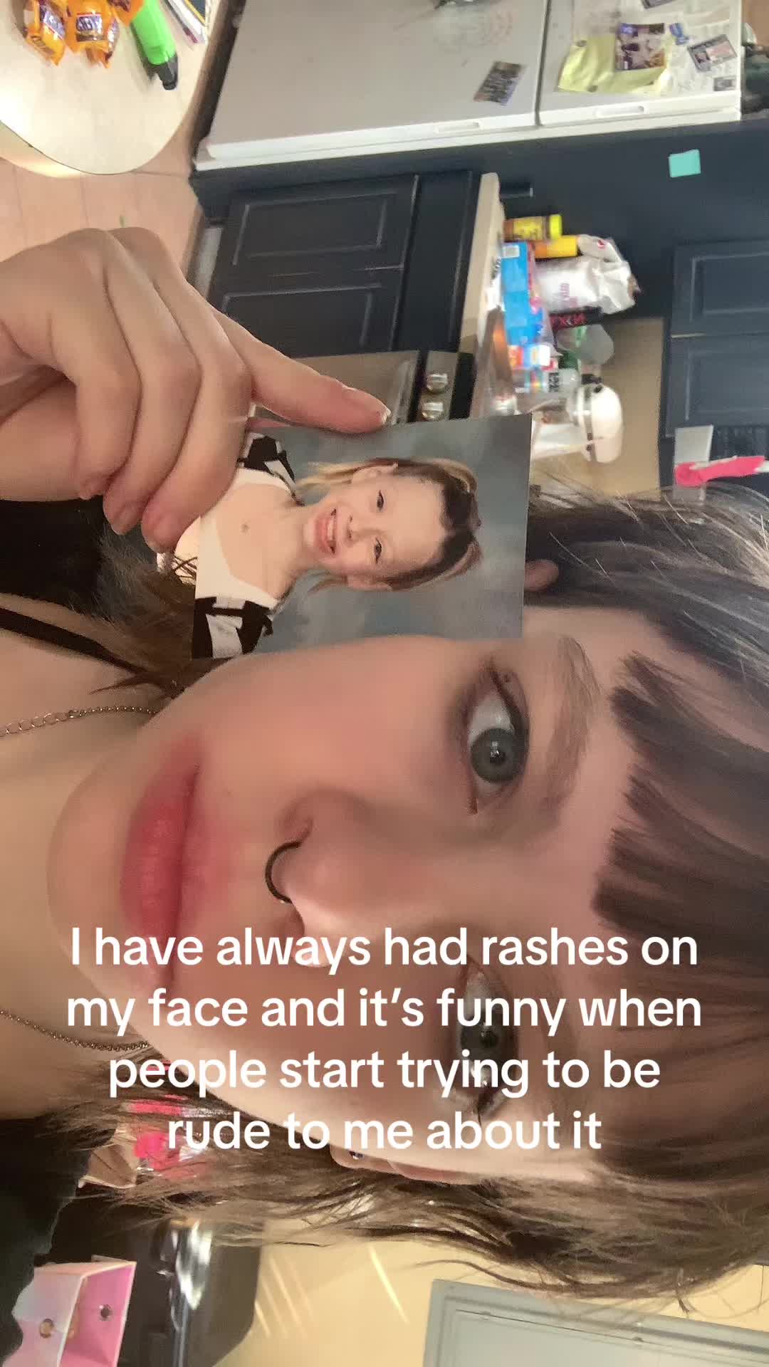 @wethefrogarestonger