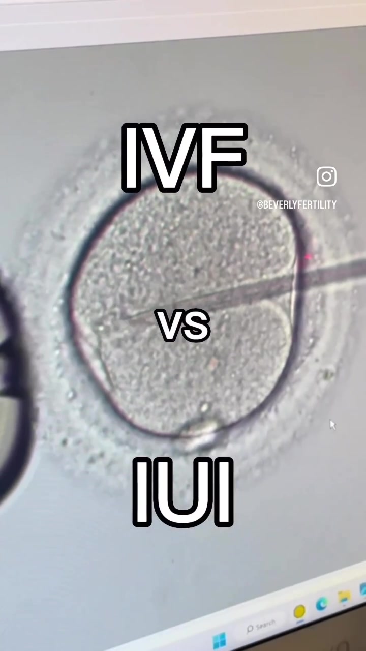 @Beverly Hills Fertility