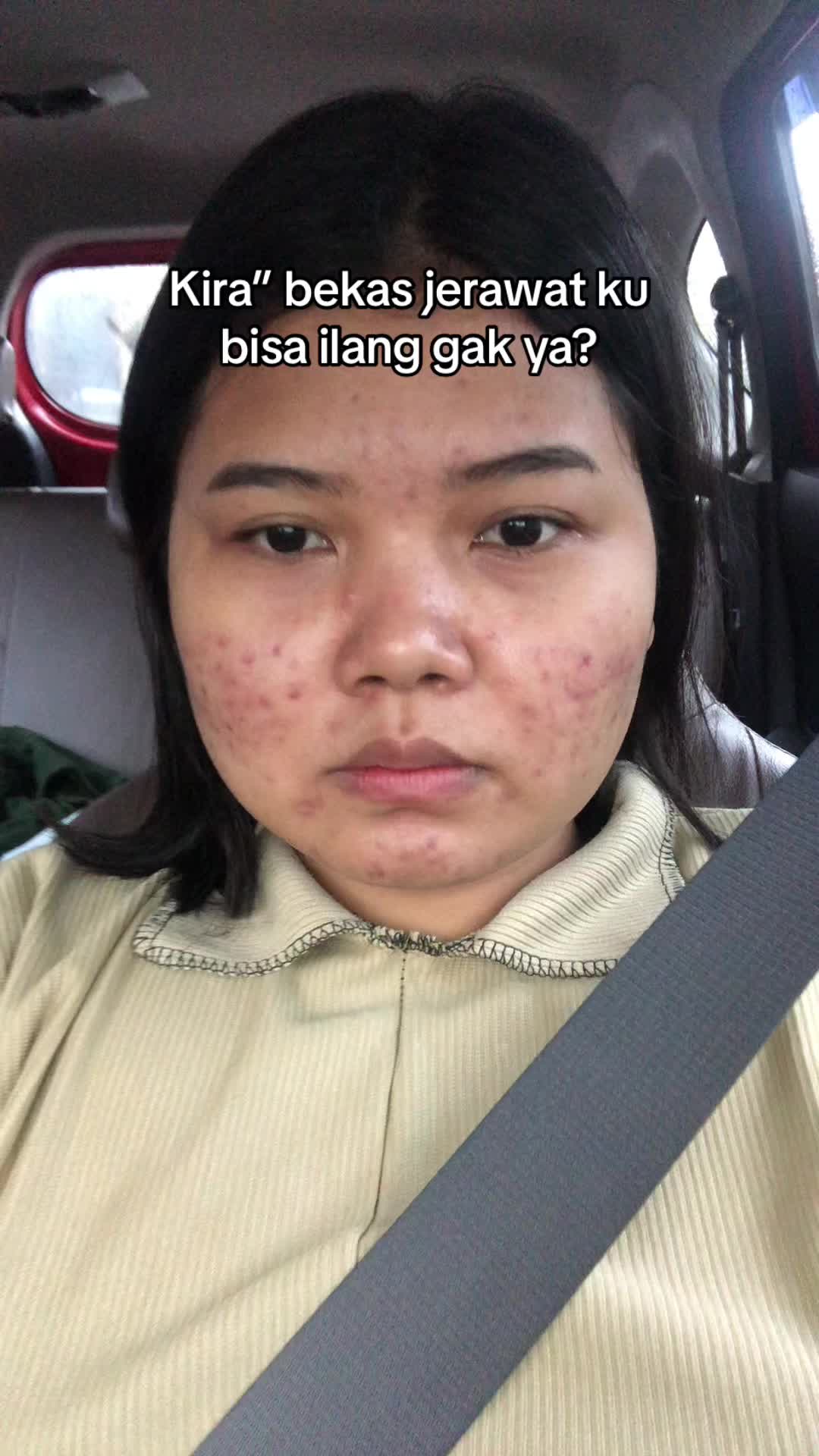 @ichi | glow up journey