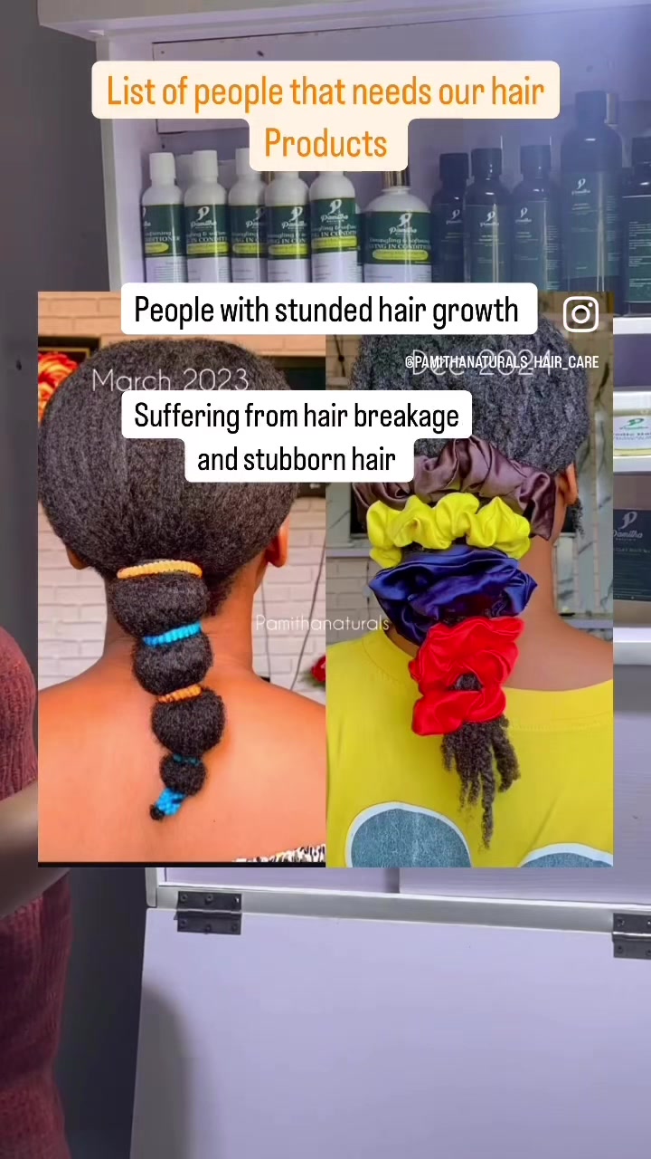 @PAMITHANATURALS | hair growth