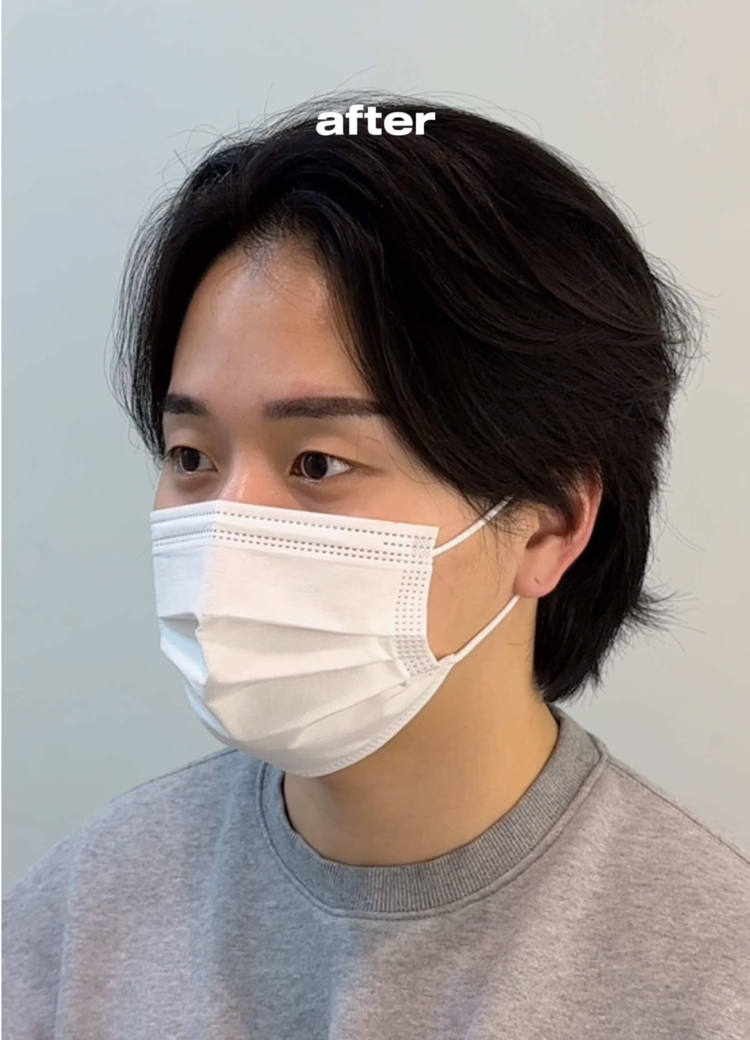 @써지브로우 surgebrow