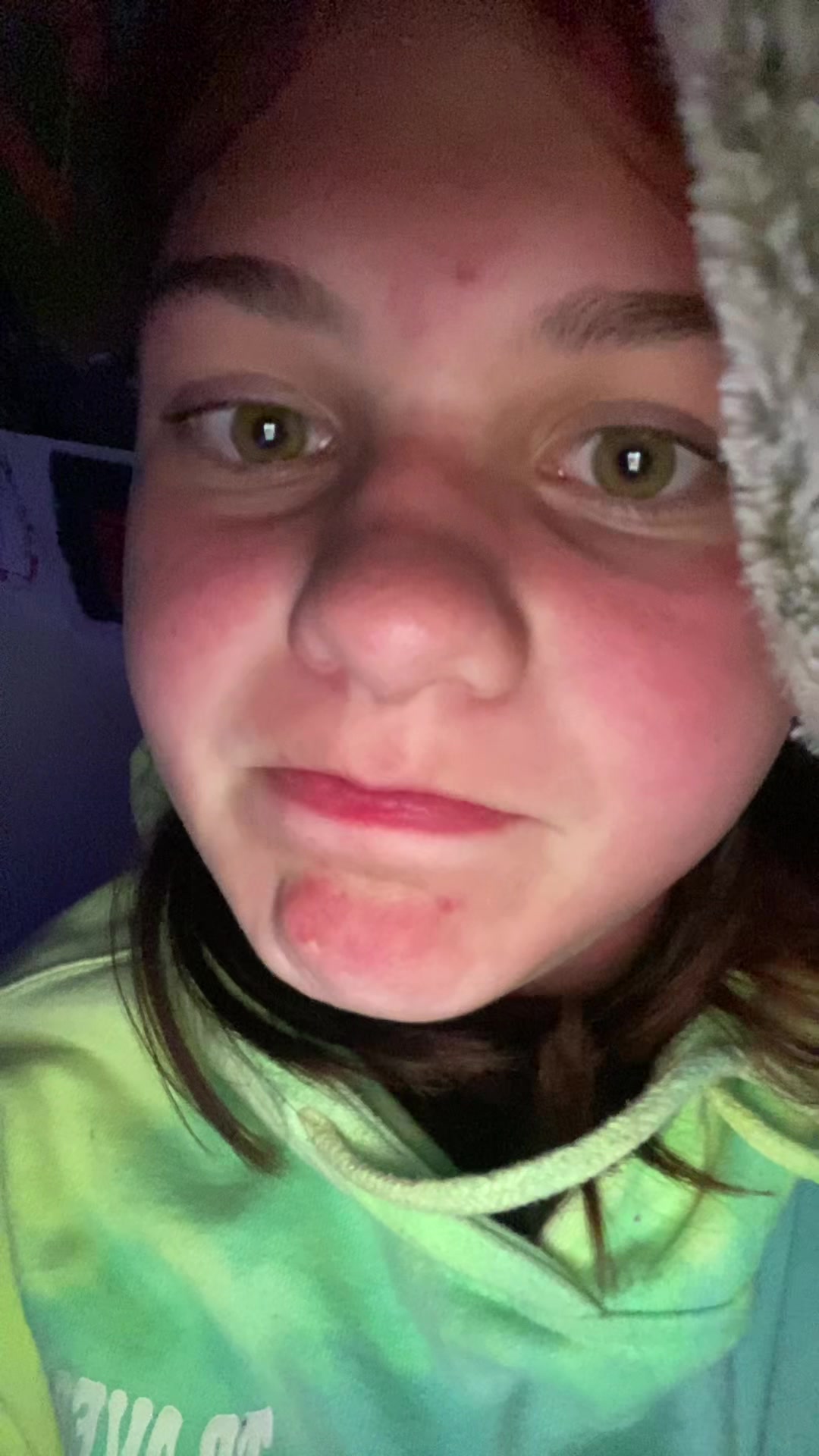 @ALEAHH
