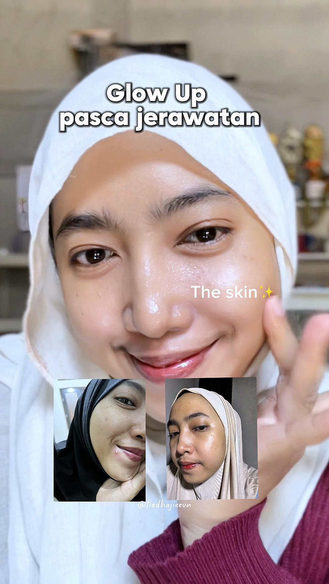 @Fie Dha Jie Eun