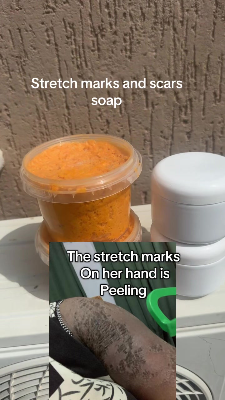 @@ Precious peeling soap