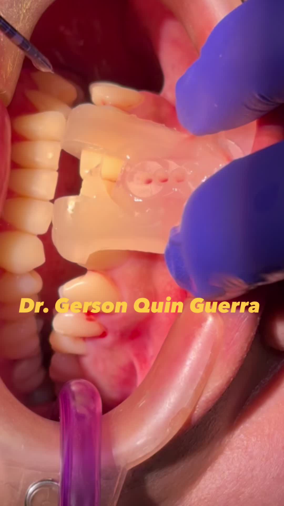@Dr. Gerson Quin Guerra, PhD