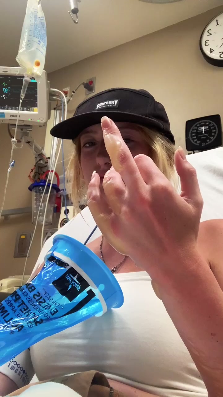 @BROTATO