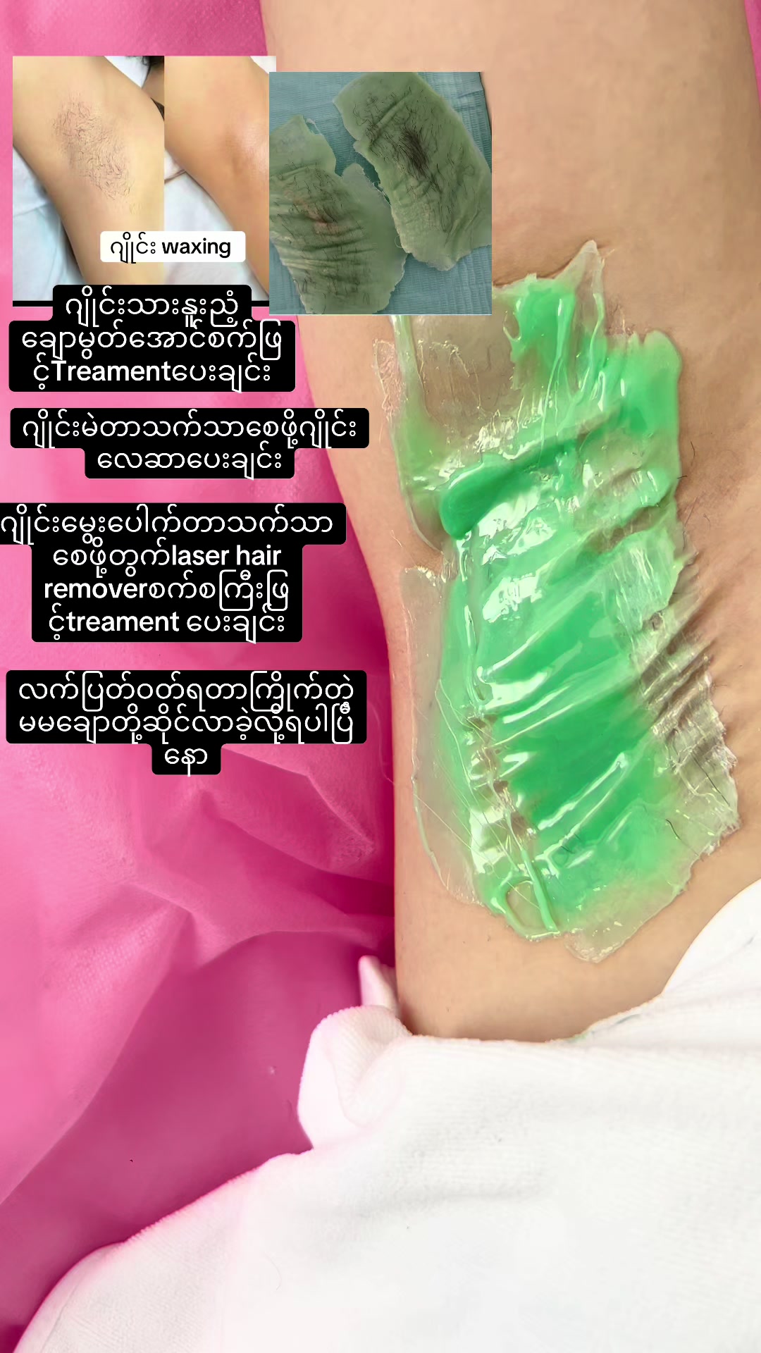 @JaJa (April Nu Beauty Clinic)