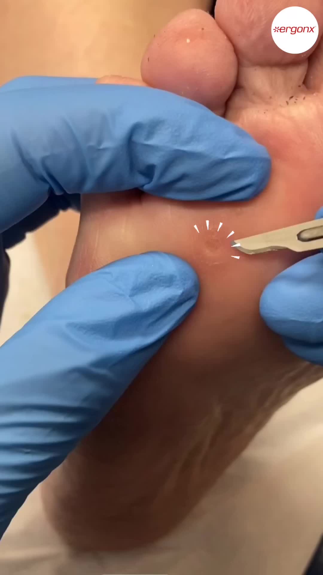 @ergonx