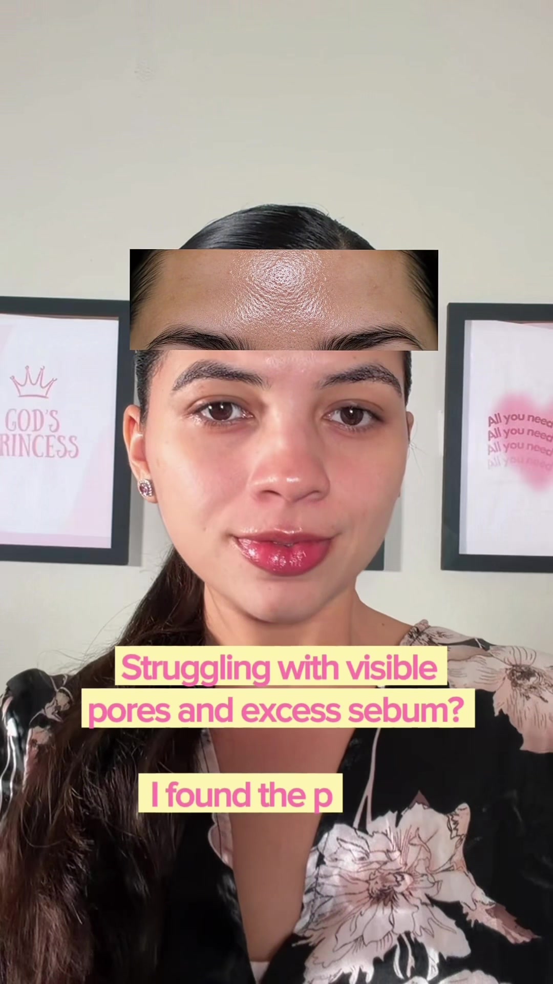 @Melissa Santos 👑🌷