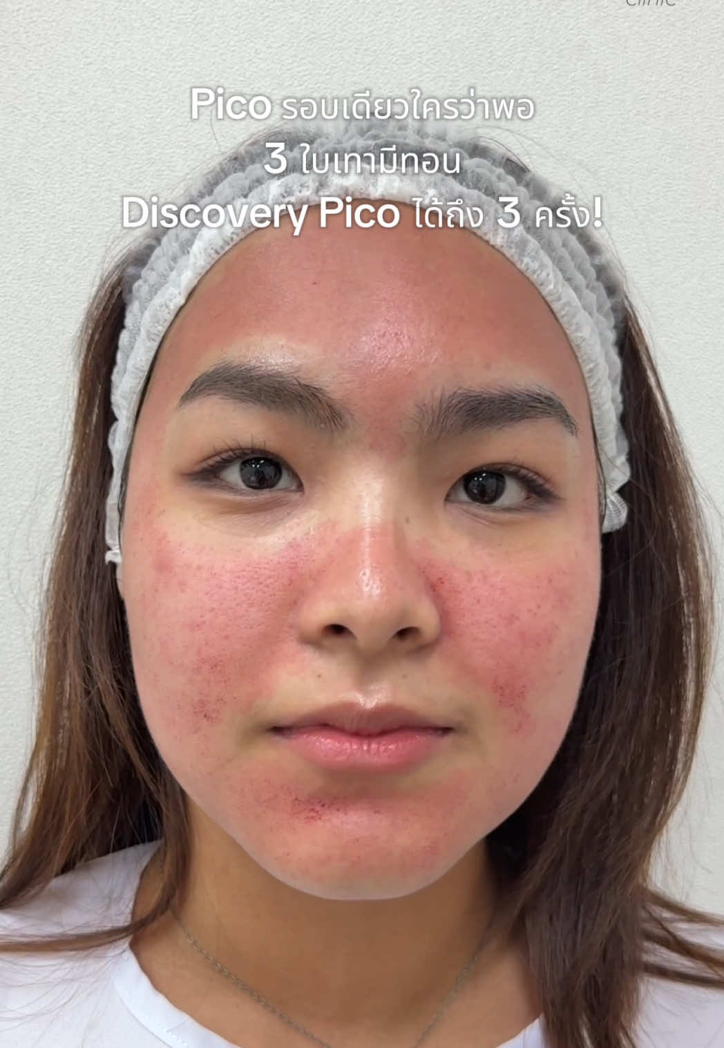 @Standard Skin clinic