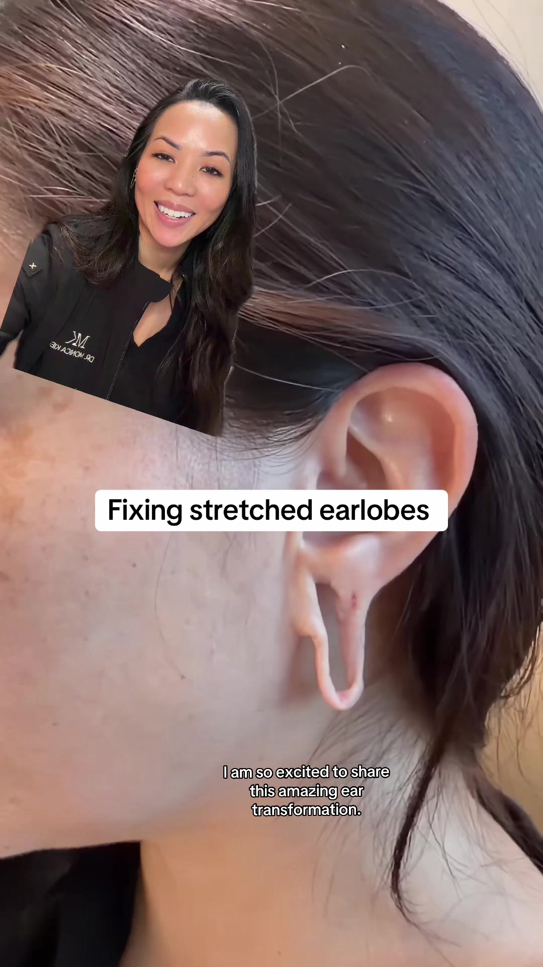 @Dr Monica Kieu | Surgeon