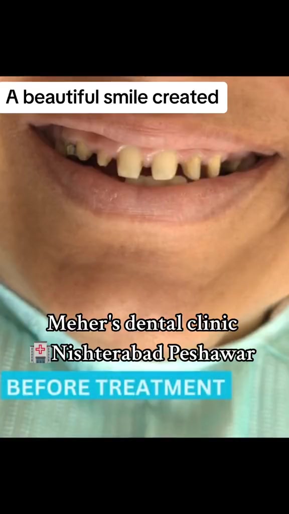 @dr_meher_official