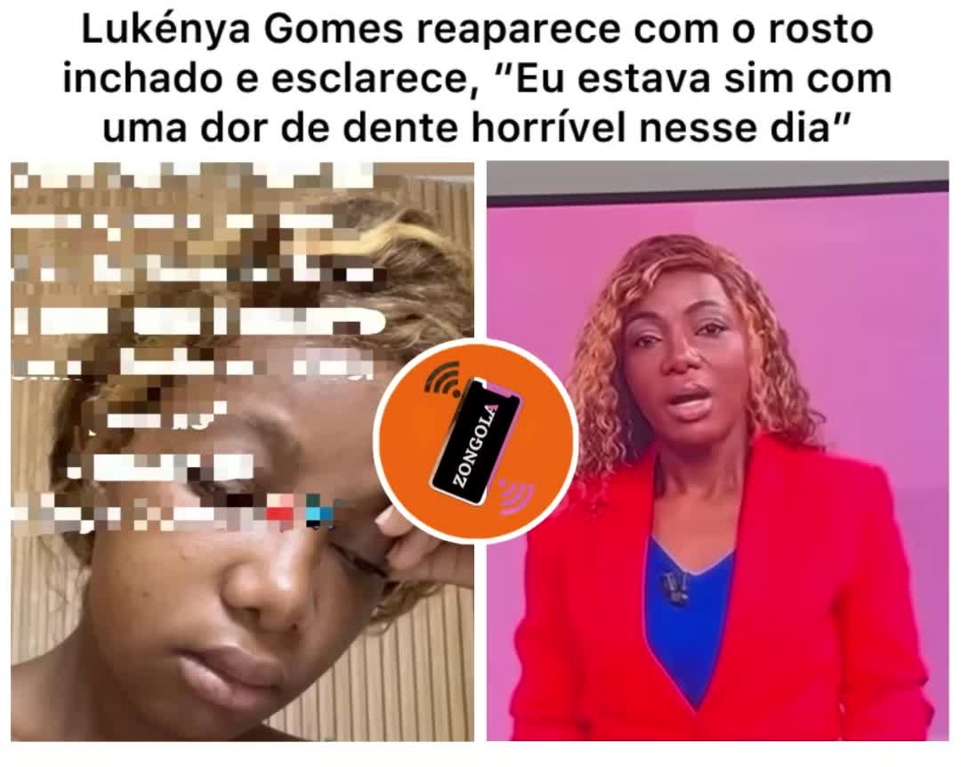 @ZONGOLA