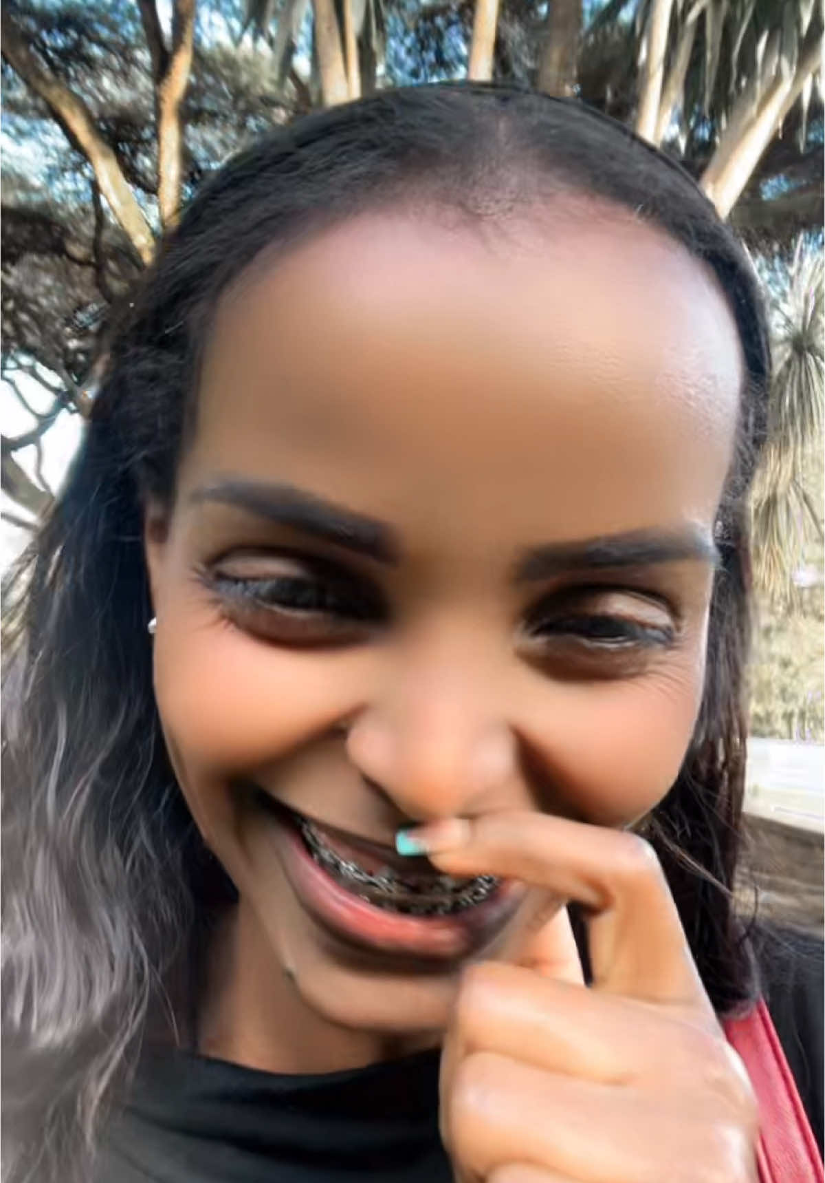 @emutiፍንጭቲያንስ🦷🦷😁
