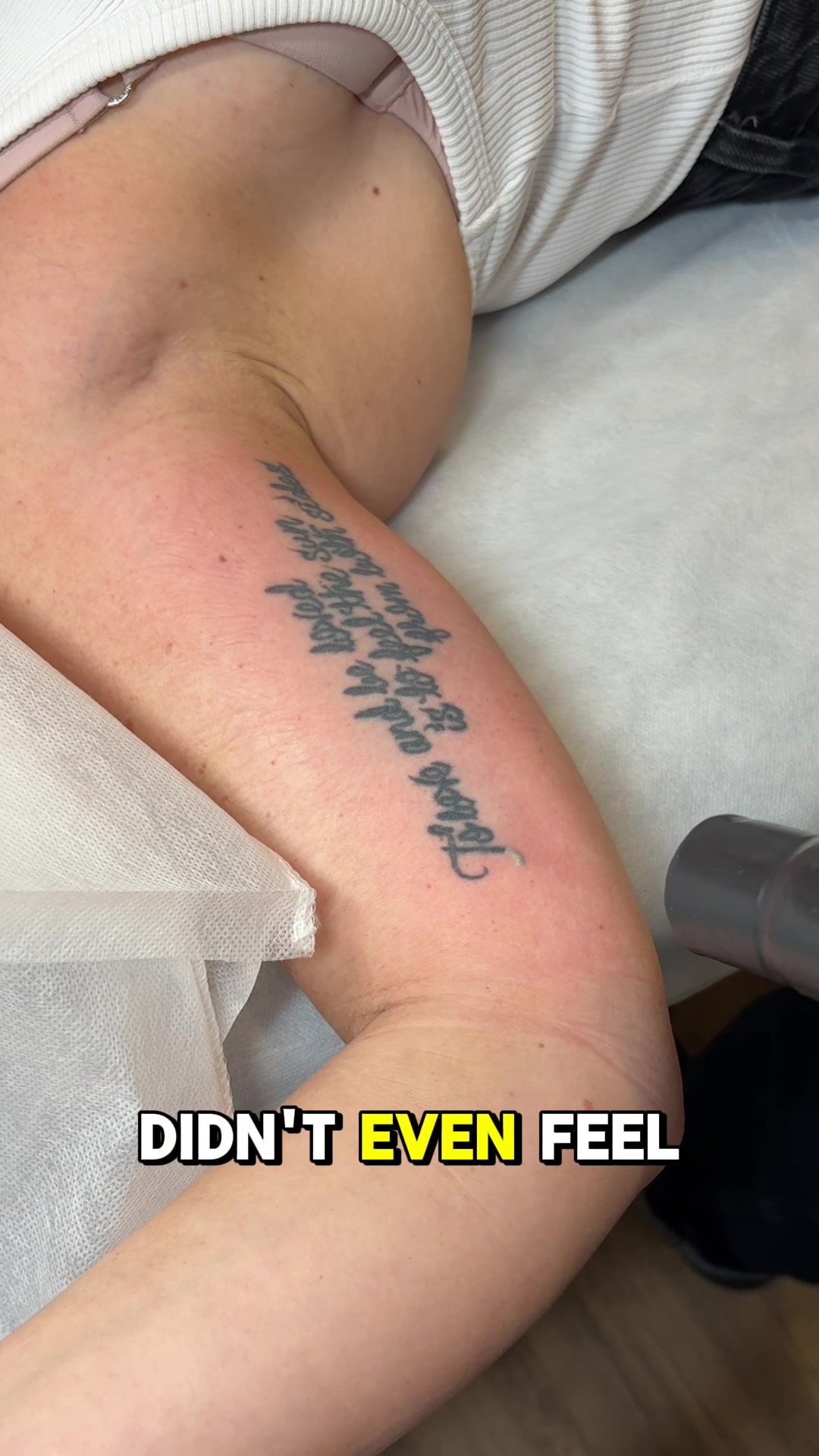 @Swift_tattoo_removal
