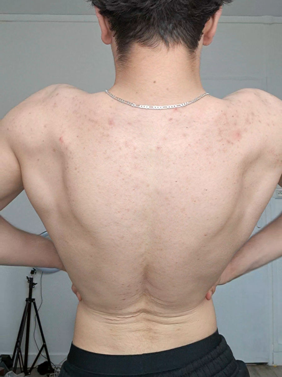 @Body king