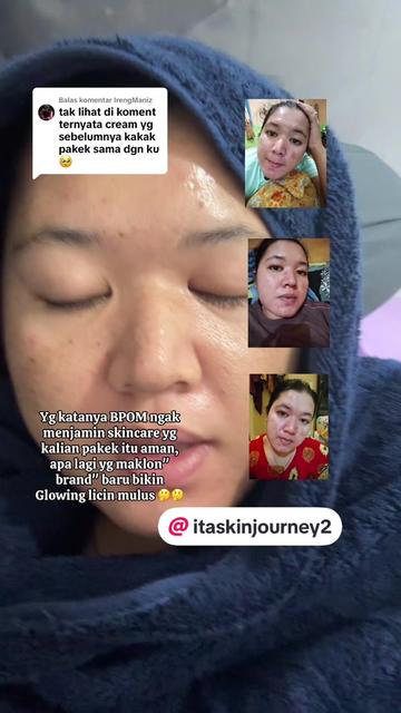 @ita_skinjourney