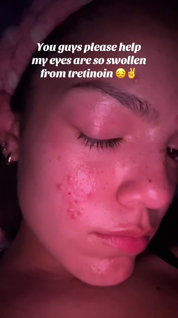 @juju
