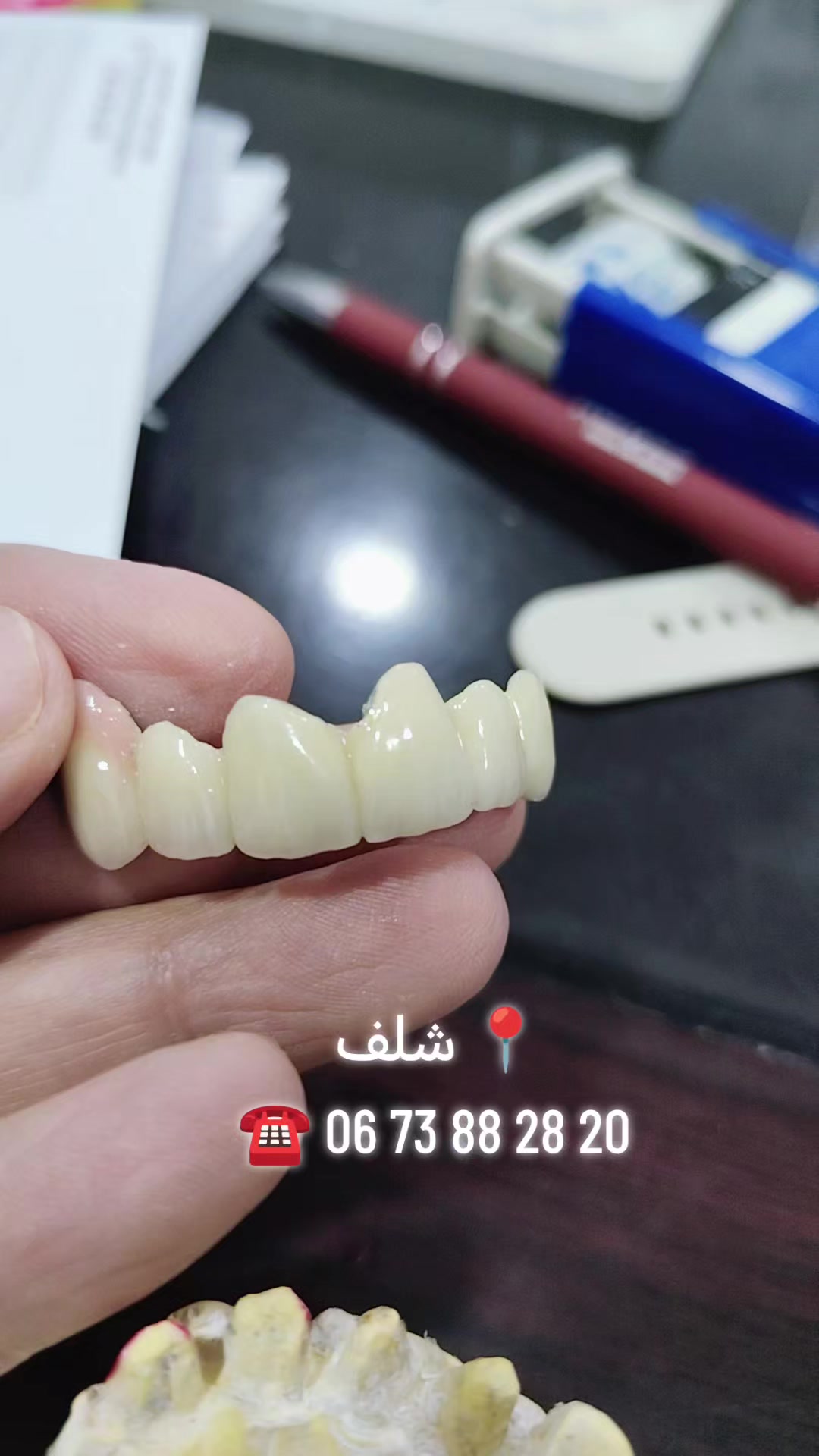 @Dr HASSOUN02 طبيبة الاسنان شلف