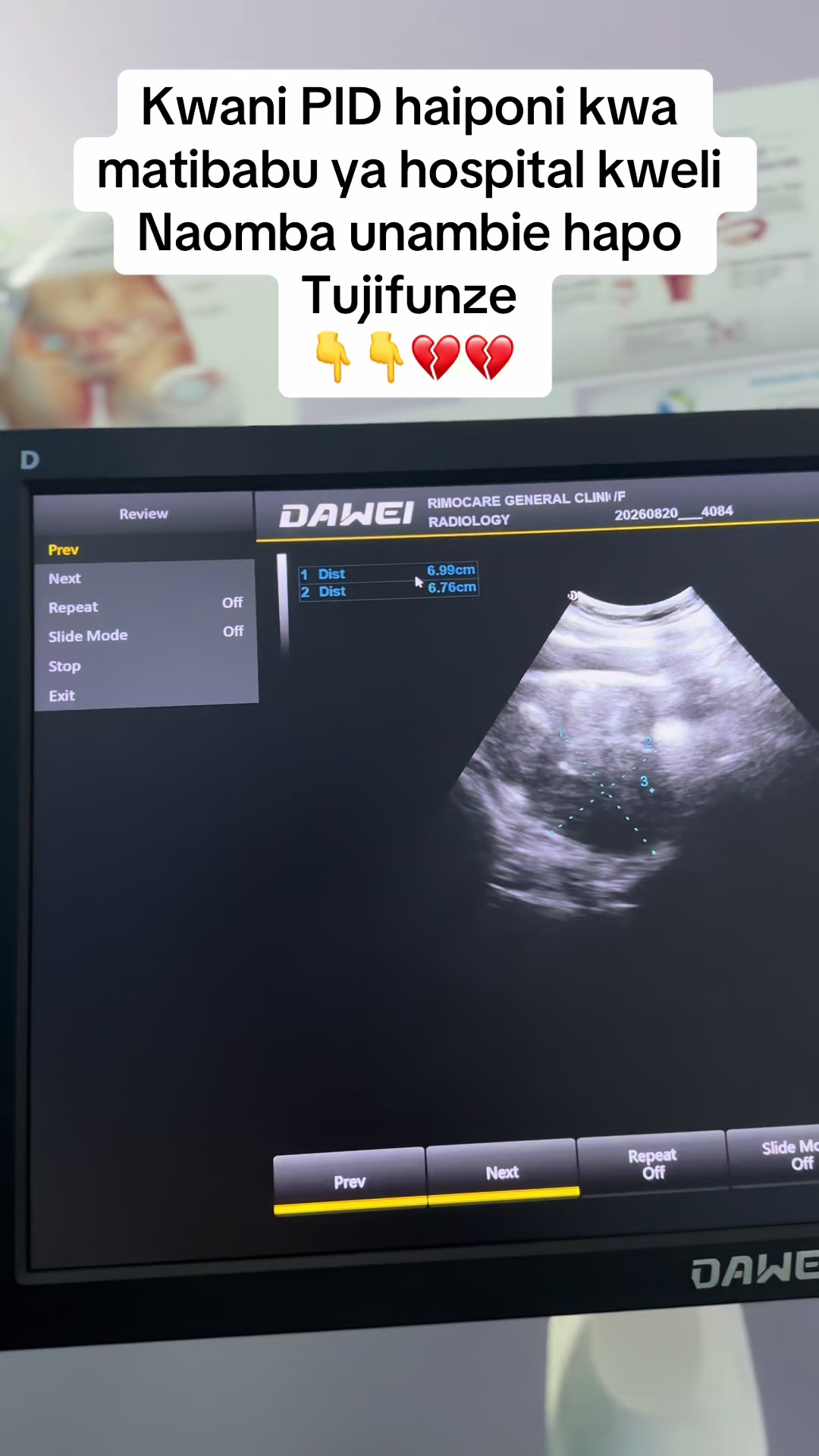 @Doctortiktoktz📞0693676137