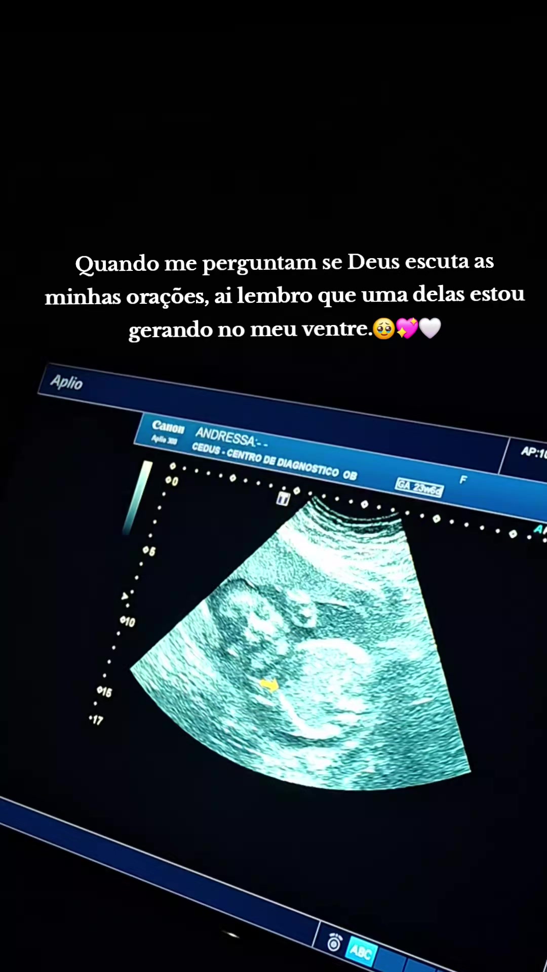 @Andressa Fonseca