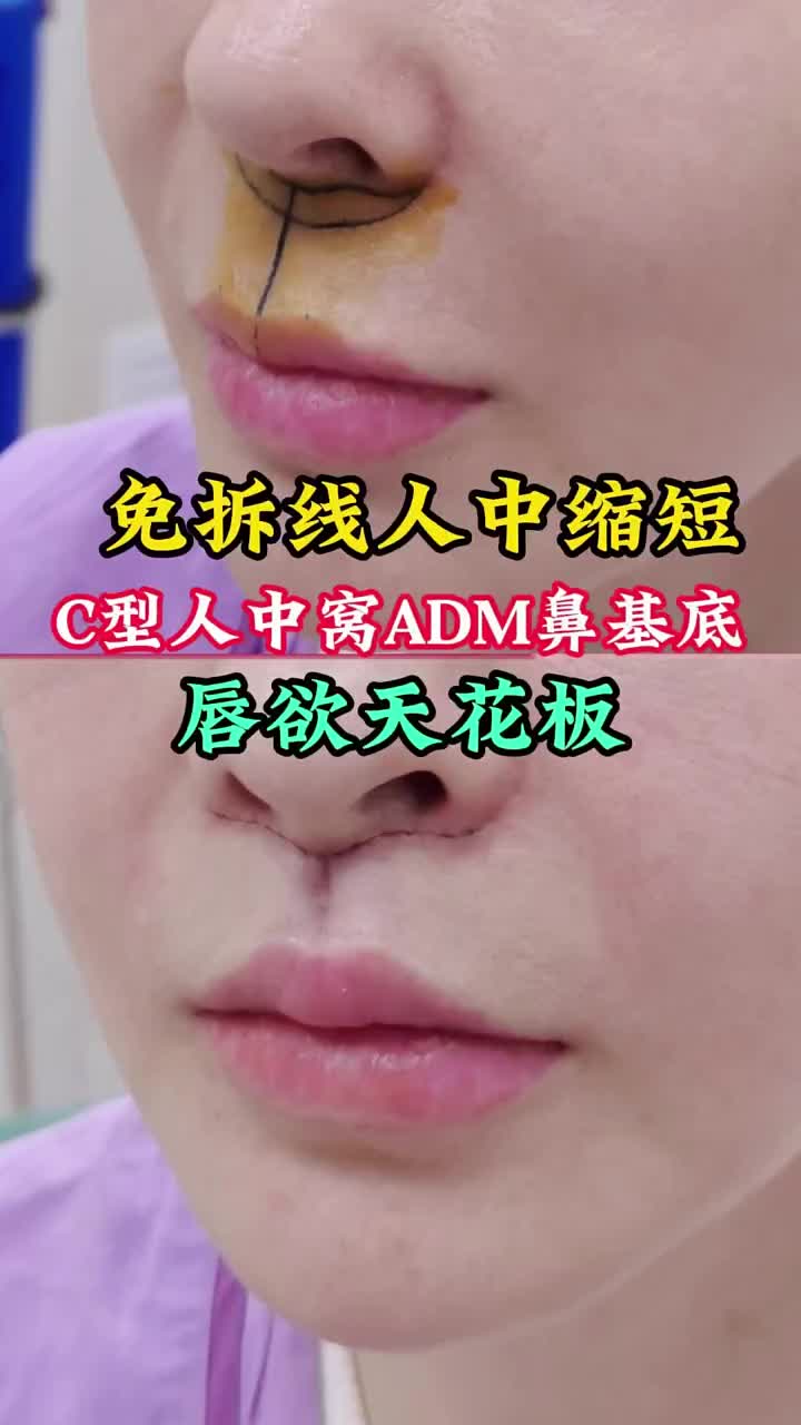 @Dr.HuJunJie