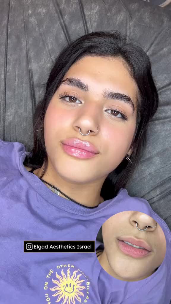 @Dr Elgad Aesthetics