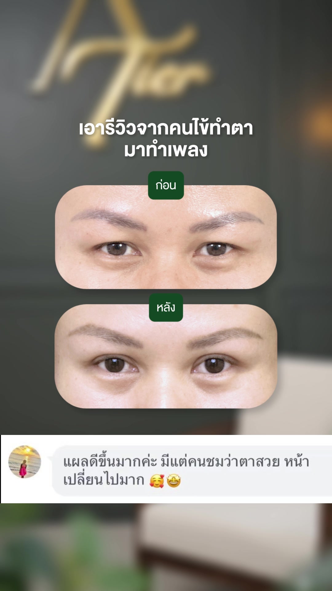 @atier.eyesurgery