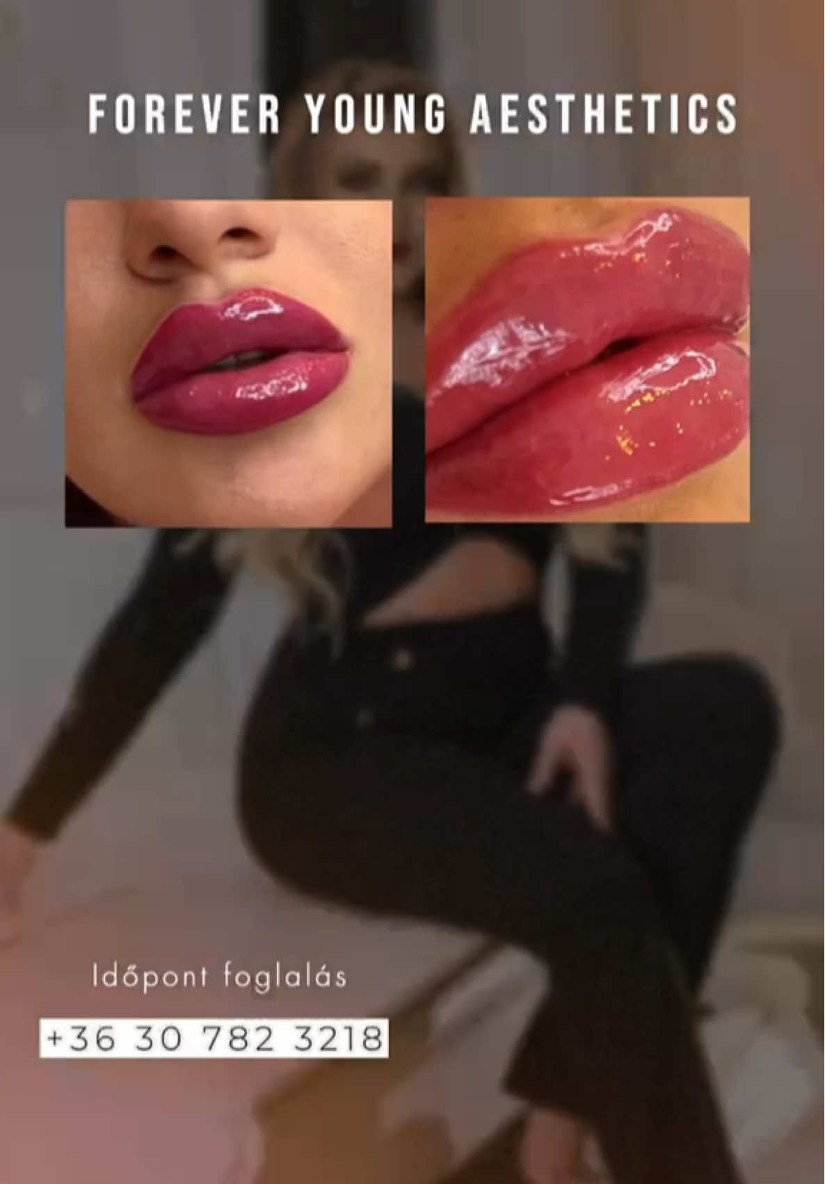 @odettoszko