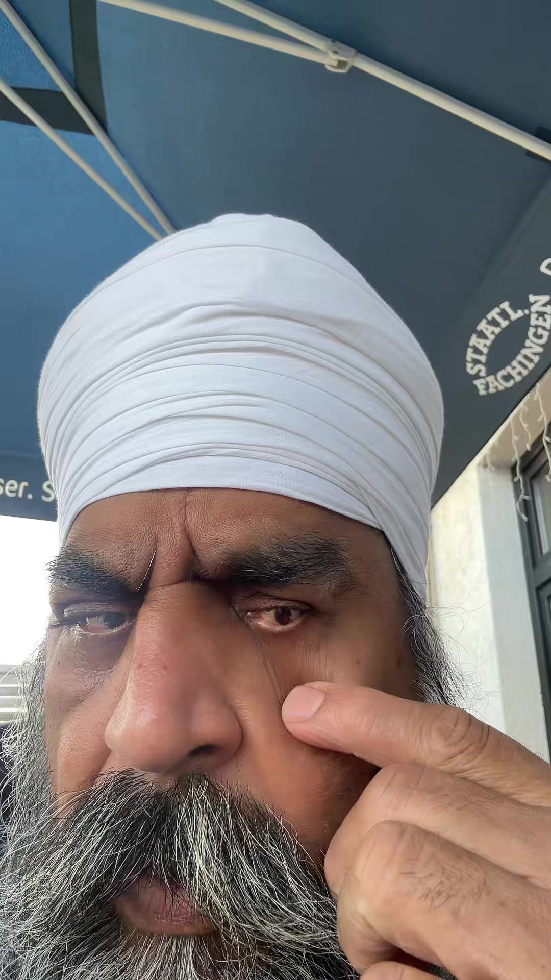 @Dr.RSF 2% Baljinder singh999