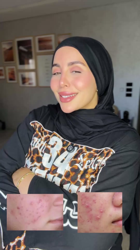 @Aya makram